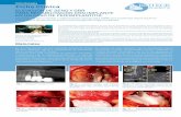 Odontologìa Ficha Clínica - Araguaney Dental · 2019-07-16 · Uno de los desafíos más difíciles es la rehabilitación de la mandíbula superior. De hecho, en esta región el