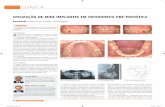 CLÍNICA - O JornalDentistry · 26 CLÍNICA Introdução A inter-relação entre a ortodontia e a prótese é muito estreita e ambas as especialidades podem beneficiar de tratamentos