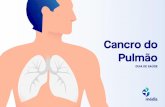 Cancro do Pulmão - Médis | O seu seguro de saúde · Responsável por 11,6% de todos os casos de cancro 5.284 novos casos diagnosticados em 2018 (9,1% do total de novos casos) Fontes: