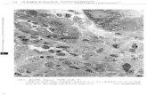 18 s granulomatosis) 23) 10 um Wegener (69)ü k) 18 giant ...nisshin-em.co.jp/atlas/p72.pdf · PDF file 18 s granulomatosis) 23) 10 um Wegener (69)ü k) 18 giant cell (G) epithelioid