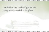 Incidências radiológicas do esqueleto axial e órgãos€¦ · PA axial – Método de Caldwell (seios da face) 15º • LOM ┴ ao filme ou a LOM a 15° da horizontal, em ortostática;