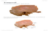 Temporal – Fabreu€“-Fernand… · Osso Temporal direito – Vista lateral Partes: escamosa, petrosa, mastóidea e timpânica. (petrosa e mastoídea estudadas juntas, petro-mastóide).