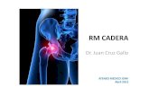 GALLO-ATENEO IDIM-RM Caderax · 2012. 4. 17. · sínfisis pubiana, diástasiso incluso quistes y osteofitos. • La TC es útil para detectar calcificaciones periarticulares. •