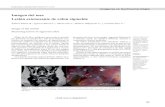 Imagen del mes Lesión estenosante de colon sigmoideimagen como pueden ser la colonoscopia, ecografía, resonancia magnética o incluso laparoscopia. El diagnóstico endoscópico de