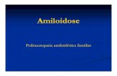 Polineuropatia amiloidótica familiar - quintela · As Polineuropatias Amiloidóticas Familiares (PAF) estão As doenças amiloidóticas englobadas nas Amiloidoses Hereditárias.