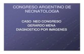 CONGRESO ARGENTINO DE NEONATOLOGIA - SAP Neonatologia... · 2016. 7. 14. · tc con contraste rm sin contraste ++-----rm con contraste +++++ hmc x 2 y uro neg. lcr: pcr herpes tipo