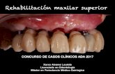 Rehabilitación maxilar superior...Urban, I. A., Lozada, J. L., Nagy, K., & Sanz, M. (2015). Treatment of severe mucogingival defects with a combination of strip gingival grafts and