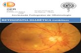 Sociedade Portuguesa de Oftalmologia - GER...(Ling et all) 4 referem prevalência de RD na diabetes de tipo1 de 49% e na diabetes de tipo 2 de 24,2%. Na diabetes de tipo 2, a prevalência
