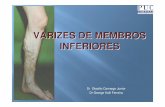 VARIZES DE MEMBROS INFERIORES - Campinas-SP