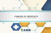 CANCER DE PRÓSTATA - TRATAMENTO COM BRAQUITERAPIA