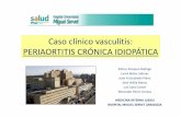 Caso clínico vasculitis: PERIAORTITIS CRÓNICA IDIOPÁTICA
