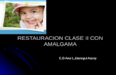 Restauracion clase II con amalgama