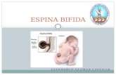 Espina bifida (Gianmarco Guzman Castillo)