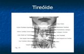 Tireóide. 1 -Tireotoxicose-Hipertireoidismo 2- Hipotireoidismo 3 - Tireoidites 4 - Bócios e Nódulos 5 - Câncer de Tireóide Disfunções tireoidianas